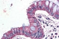 GPR116 Antibody, Novus Biologicals 50 &mu;g; Unconjugated:Antibodies, Polyclonal
